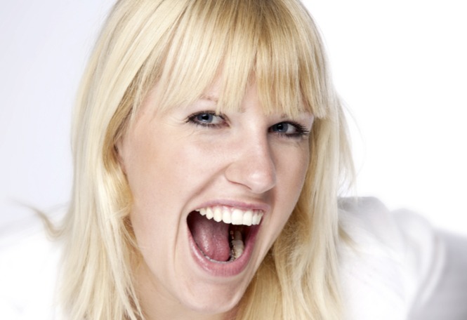 ¿Alineadores invisibles o Brackets linguales? 2ª parte