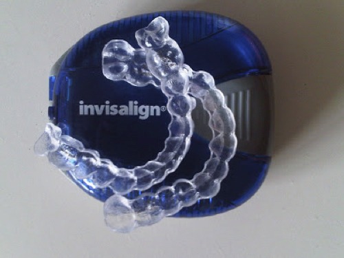 INVISALIGN: ¿FULL O LITE?
