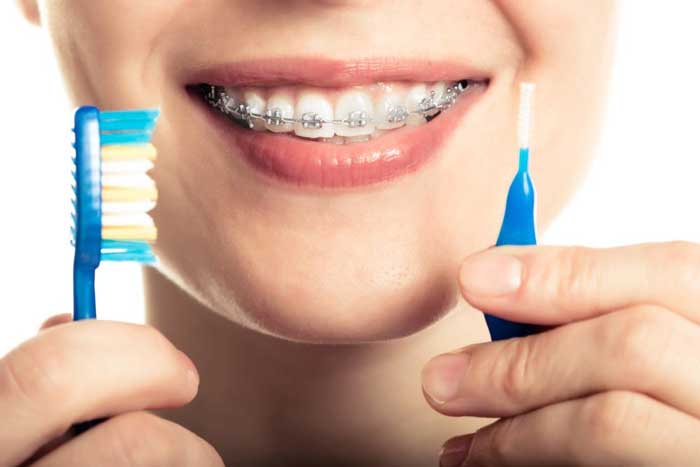 En Clínica Kaizen resolvemos tus dudas de higiene dental durante tu ortodoncia